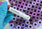 CORONAVIRUS EN ARGENTINA: ESTE DOMINGO CONFIRMARON 41 NUEVOS CASOS Y EL TOTAL ES 266 EN EL PAÍS