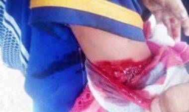 SALTA: POR $20 ATACO A SUS HIJOS CON UN MACHETE 