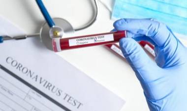 HAY 285 NUEVOS CASOS Y 2 MUERTOS POR CORONAVIRUS EN ARGENTINA