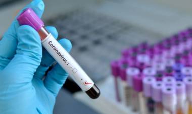 CORONAVIRUS EN SAN LUIS: ESTE JUEVES SE REGISTRARON 76 CASOS POSITIVOS EN LA PROVINCIA Y SE SUMARON 3 DECESOS