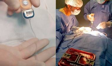 UN NUEVO MODELO DE IMPLANTE LE PERMITIRÁ VOLVER A ESCUCHAR A DOS PERSONAS EN SAN LUIS