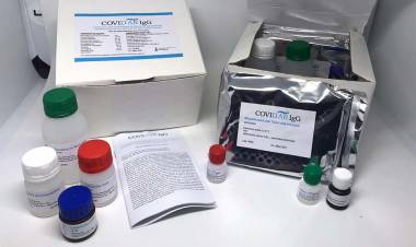 CIENTÍFICOS ARGENTINOS DESARROLLARON UN KIT QUE ACELERA LOS TESTEOS DE CORONAVIRUS