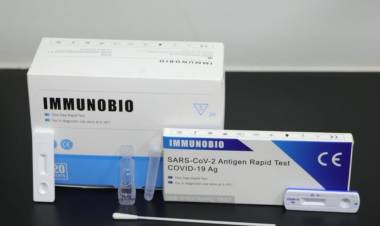 TEST RÁPIDO DE CORONAVIRUS: LA ANMAT AUTORIZÓ LA VENTA LIBRE EN FARMACIAS DE TODO EL PAÍS