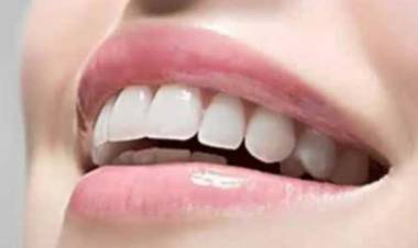 DESARROLLARON UN ESMALTE ARTIFICIAL PARA REPARAR PIEZAS DENTALES, MEJOR QUE EL ORIGINAL