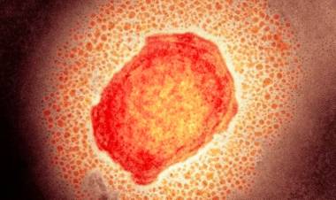 VIRUELA DEL MONO, BROTES EN VARIOS PAÍSES: QUÉ ES, CÓMO SE TRANSMITE Y CUÁLES SON SUS SÍNTOMAS