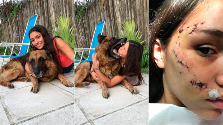 EN TUCUMÁN UNA JOVEN SE FOTOGRAFIÓ CON LA PERRA DE SU AMIGO Y TERMINÓ CON MÁS DE 20 PUNTOS EN LA CARA