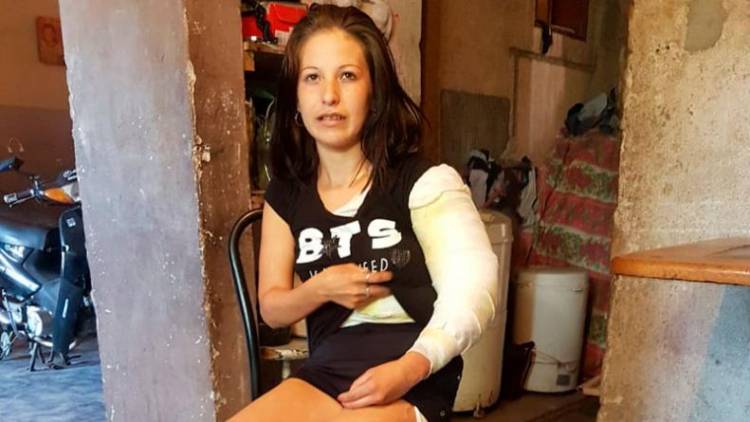 SU EX PAREJA LA ROCIÓ CON ALCOHOL Y LA PRENDIÓ FUEGO