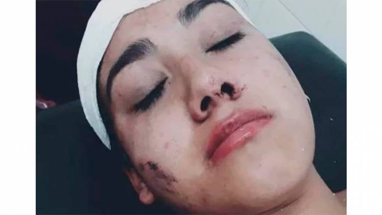 UNA JOVEN FUE ATACADA EN SANTA FE POR UNA PATOTA EN UN BOLICHE