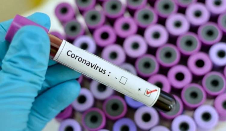 CHACO: FALLECIÓ EL SEXTO PACIENTE CON CORONAVIRUS EN ARGENTINA, EL SEGUNDO EN MENOS DE 24 HORAS