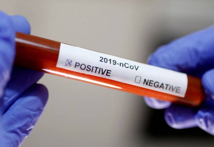 DOS CASOS POSITIVOS DE CORONAVIRUS EN SALTA