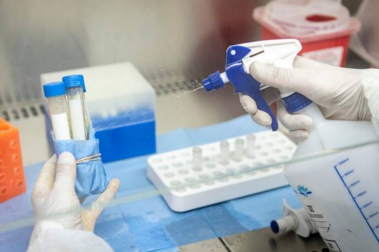 HAY 188 NUEVOS CASOS Y 9 MUERTOS POR CORONAVIRUS EN ARGENTINA