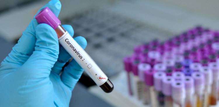 CORONAVIRUS EN SAN LUIS: ESTE JUEVES SE REGISTRARON 76 CASOS POSITIVOS EN LA PROVINCIA Y SE SUMARON 3 DECESOS
