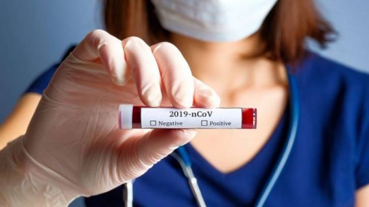 CORONAVIRUS EN SAN LUIS: ESTE SÁBADO SE REGISTRARON 54 CASOS POSITIVOS Y 1 FALLECIMIENTO