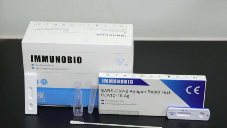 TEST RÁPIDO DE CORONAVIRUS: LA ANMAT AUTORIZÓ LA VENTA LIBRE EN FARMACIAS DE TODO EL PAÍS