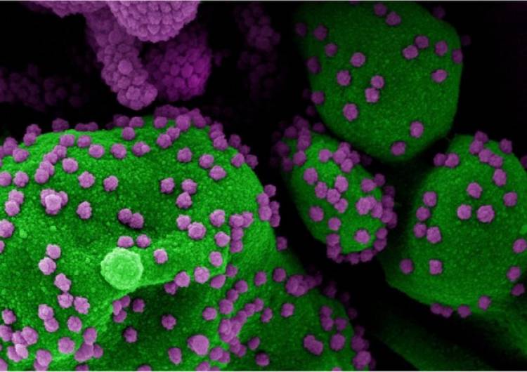 ITALIA: DETECTARON UNA NUEVA VARIANTE DE CORONAVIRUS