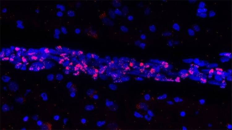 NUEVO DESCUBRIMIENTO: COVID-19 PROVOCA LA MUERTE DE IMPORTANTES CÉLULAS DEL SISTEMA VASCULAR CEREBRAL