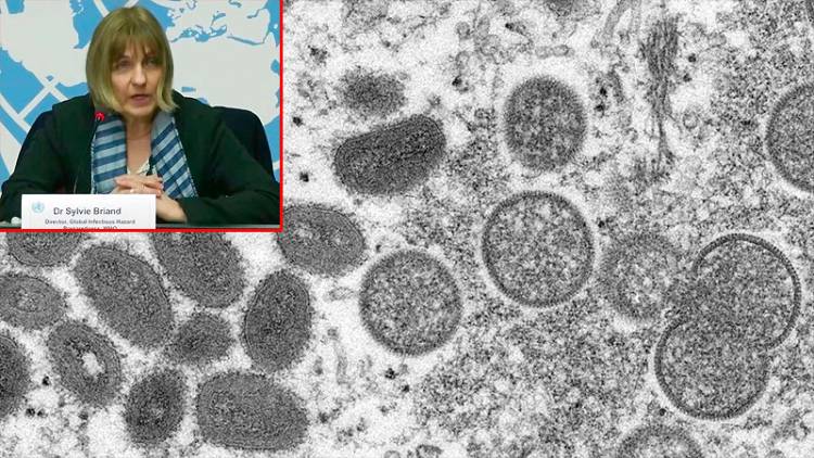 LOS CASOS DE VIRUELA DEL MONO PODRÍAN SER LA "PUNTA DEL ICEBERG" ES LO QUE MANIFIESTA LA OMS