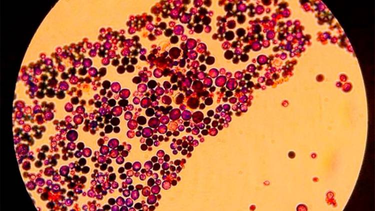 "LA ENFERMEDAD INFECCIOSA OLVIDADA": LA OMS DIO A CONOCER LA LISTA DE 19 HONGOS QUE AMENAZAN LA SALUD MUNDIAL